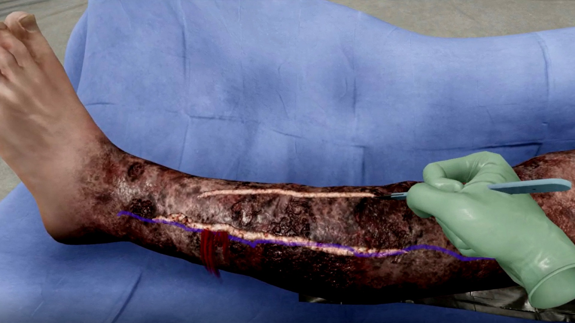 View of user making an incision on simulated patient using haptics. 
